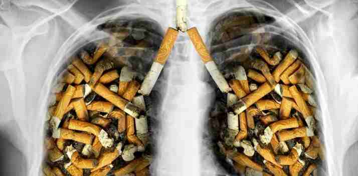 Akibat Merokok, Penyakit Kronis Bersarang Pada Organ Tubuh