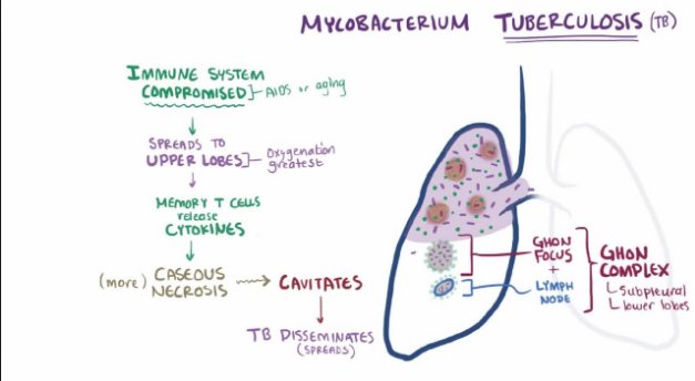 Gejala TBC dan cara mengatasinya